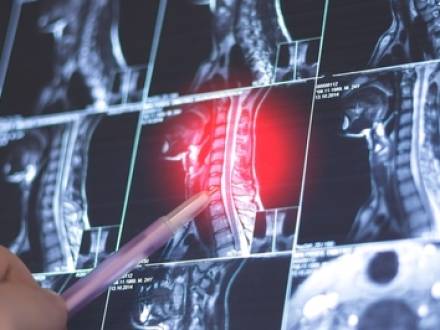 Los Angeles, CA personal injuy lawyer